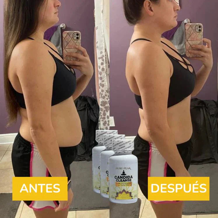 Candida Cleanse™ Decile chau a la panza hinchada, los antojos y el cansancio en menos de 30 días